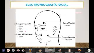 Electrocardiograma y Electromiograma [upl. by Suiravat]