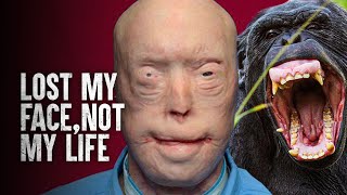 How I Survived a Chimpanzee Attack [upl. by Yevol915]