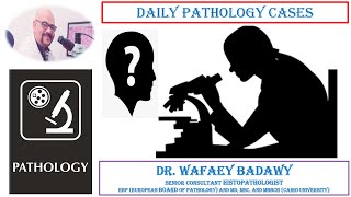 DAILY PATHOLOGY CASES CASE NO7  DR WAFAEY BADAWY [upl. by Cacilie516]