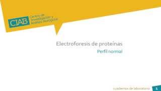 Electroforesis de proteínas perfil normal CIAb wwwciabes [upl. by Korten239]