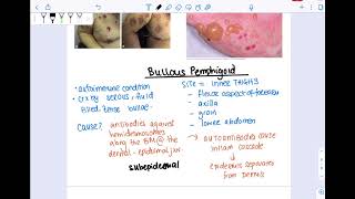 Bullous pemphigoid vs Pemphigus vulgaris [upl. by Norm]