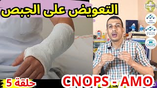 تعويض الجبص كنوبس سنيسيس امو تضامن شامل Platre CNOPS CNSS AMO [upl. by Lumbard883]