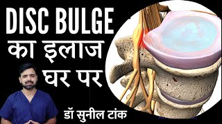 Acute lumbar disc bulge Exercises at home  Dr Sunil Tank Hindi [upl. by Yendic]