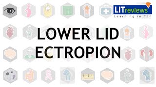 Lower Lid Ectropion [upl. by Sitsuj283]