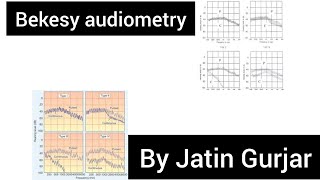 BEKESY audiometry  differential diagnosis of cp and rcp by bekesy audiometry by Jatin gurjar [upl. by Nsaj]