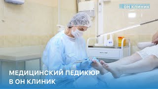 Медицинский педикюр в ОН КЛИНИК  Когда необходимо делать педикюр в клинике [upl. by Einuj]