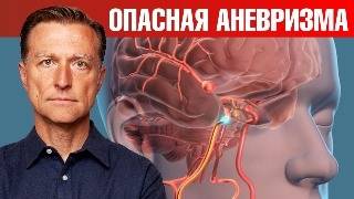 Боитесь инсульта Бойтесь АНЕВРИЗМЫ ☠ Причины аневризмы [upl. by Licht]