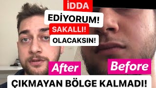 3 DAKİKA DA NASIL SAKAL ÇIKARABİLİRSİN İZLE VE GÖR DOĞAL [upl. by Inalawi]