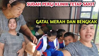 MAMAK BIRING MALAM MALAM DATANG LIHAT BADAN SAYA BENGKAK MERAH DAN GATAL SEMUA [upl. by Yrekaz596]