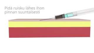 Injektiona annettavan rokotteen antotavat [upl. by Mosier74]