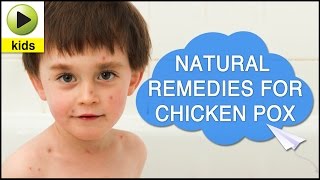 Kids Health Chicken Pox  Natural Home Remedies for Chicken Pox [upl. by Hakan872]