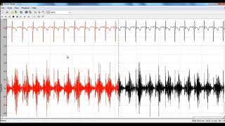 Phonocardiogram Signals Matlab Projects  Phonocardiogram Signals Matlab Thesis [upl. by Ynos]