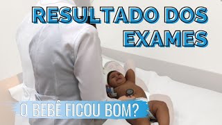 CONSULTA MENSAL DO BEBÊ 9 MESES PUERICULTURA [upl. by Airdnaxila]