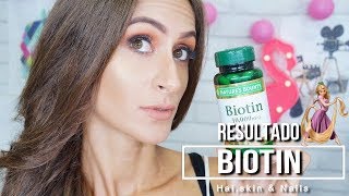 Resultado da Biotin 10000mg Biotina [upl. by Deckert]