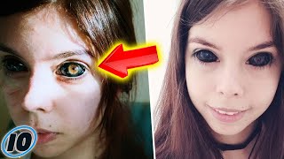 Model Left Blind After Tattooing Her Eyes Black [upl. by Ecaroh512]