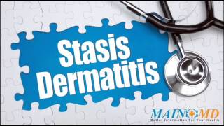 Statis Dermatittis ¦ Treatment and Symptoms [upl. by Dnomayd972]