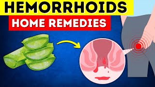 Say Goodbye to Hemorrhoids 8 Home Remedies That Actually Work [upl. by Bornstein616]