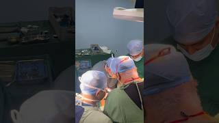 Hepatectomy I Advanced GI SURGERY I Liver Team I Surat I India [upl. by Ryder]