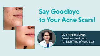 Say Goodbye to Your Acne Scars Dr T N Rekha Singh Describes Treatments For Each Type of Acne Scars [upl. by Duffie775]