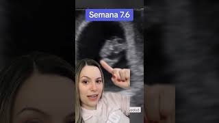 Embrión de 7 semanas  6 días ❤️ embarazo embrion vida [upl. by Perlman425]