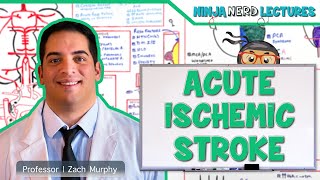 Acute Ischemic Stroke Etiology Pathophysiology Clinical Features Diagnostics Treatment [upl. by Jolenta]