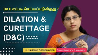 When and How Dilation and Curettage DampC Done  DampC எப்படி செய்யப்படுகிறது  Dr Suganya Anandaraman [upl. by Ransell]