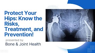 quotUnderstanding Hip Fractures Causes Symptoms and Treatment Options for a Speedy Recoveryquot [upl. by Louis]