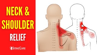 How to Fix Neck and Shoulder Pain FOR GOOD [upl. by Kcinemod750]