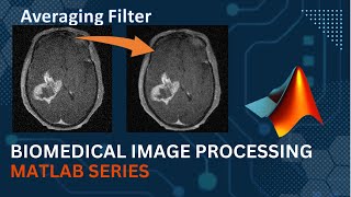 Averaging Filter  MATLAB Code Implementation  Medical Image Processing  Computer Vision [upl. by Zamora]