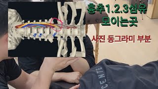 경장근 촉진longus colli palpation 및 도수운동manipulation motion 뒷목이 뻐근할때ㅡ》 경장근이 이완이 안되서 경추 신전근이 뭉친경우 [upl. by Lakym]