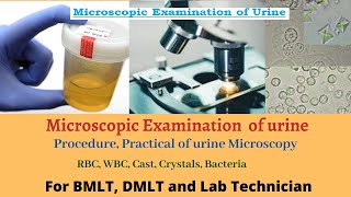 Microscopic examination of urine  urine microscopic examination  urine microscopy  urine test [upl. by Lerret454]