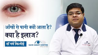 Do you know these facts about watery eyes   Symptoms Causes amp Treatment  Dr Garv Bishnoi [upl. by Shannah]