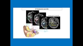 CTAnatomie vom Ohr  Strahlentherapie Prof Hilke Vorwerk [upl. by Becki291]