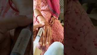 INTRAVENOUS INJECTION PROCEDURE ll INTRAVENOUS INJECTION demonstration ll IV INJECTION ll video ll [upl. by Nahsor77]