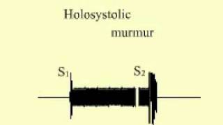 Holosystolic Murmur [upl. by Gwendolin262]