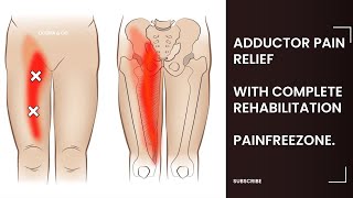 Groin painadductor strainpain reliefrehabilitation PAINFREEZONE [upl. by Darb6]