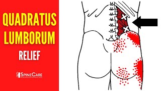 How to Fix Quadratus Lumborum Pain FOR GOOD [upl. by Etnahs]