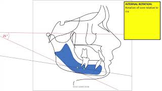 mandibular rotation [upl. by Anoet467]