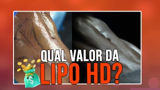 QUAL PREÇO DA LIPO HD  CIRURGIA PLÁSTICA [upl. by Kepner]