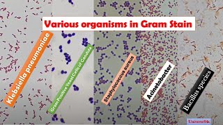 Various Bacteria Gram Stain MicroscopyGrampositive rodsGramNegative RodsGrampositive cocci [upl. by Eirruc]