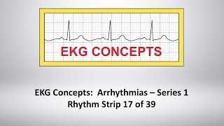 EKG Concepts Arrhythmias Course  Strip 17 of 39 [upl. by Enriqueta314]