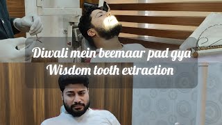 Wisdom tooth extraction  Vaayu ke qisse [upl. by Alyled]