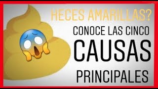 ✅Heces amarillas y las principales causas VÍDEO MUY IMPORTANTE [upl. by Joh]