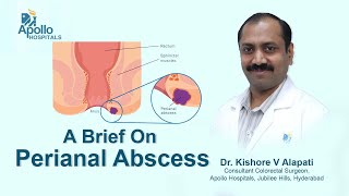 Perianal Abscess  Dr Kishore V Alapati  Colorectal Surgeon  Apollo Hospital Hyderabad [upl. by Burr148]