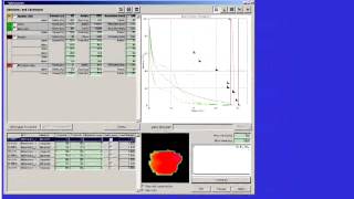 IGRT CBCT Adaptive [upl. by Ing768]