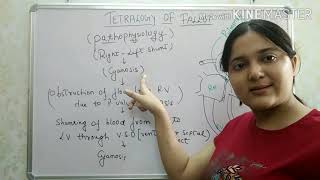 quotTetralogy of fallotquot CYANOTIC CONGENITAL HEART DISEASE PART 1 [upl. by Redla489]