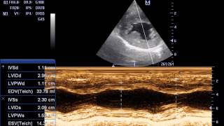 ECOCARDIOGRAFIA DOPPLER ESTENOSIS SUBAORTICA EN CANINOS IVAN ALVAREZ [upl. by Margarida]