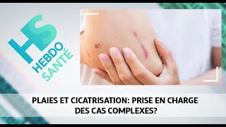 Plaies et cicatrisation prise en charge des cas complexes [upl. by Assirat]