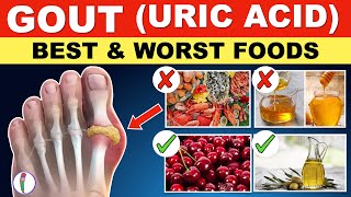 Uric acid Foods to Avoid  Gout Diet Meal Plan  Gout  Uric acid  Best amp Worst Foods [upl. by Sharleen440]