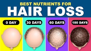 Hair fall Treatment  Hair Loss Treatment for Men  How to stop hair fall  Hair RegrowthNUTRIENTS [upl. by Grantham596]